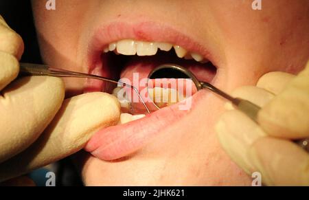 File photo dated 19/05/11 of a general view of a dentist at work, as healthy people will only need a check-up with their NHS dentist every two years under a push to improve access to dental care. Stock Photo