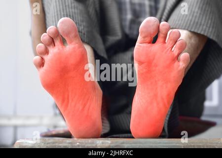 Tingling and burning sensation in feet of Asian old man with diabetes. Foot pain. Sensory neuropathy problems. Foot nerves problems. Plantar fasciitis Stock Photo