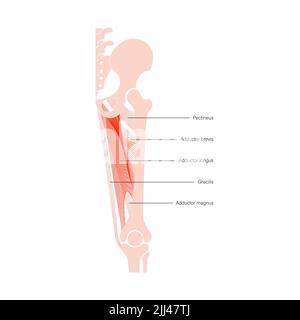 Medical Illustration of Hip Adductor Muscles Stock Photo - Alamy