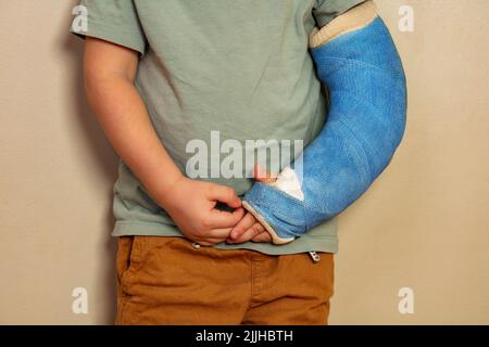 Isolated blue cast stock photo. Image of injury, copyspace - 11292308