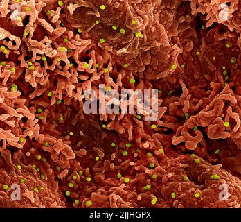 Fort Detrick, United States. 26th July, 2022. A colorized scanning electron micrograph of monkeypox virus (lime) on the surface of infected VERO E6 cells (orange) captured at the NIAID Integrated Research Facility released July 26, 2022, in Fort Detrick, Maryland. Credit: NIAID/NIAID/Alamy Live News Stock Photo