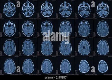 digital images of a computer tomography of a human head Stock Photo