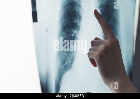 a pointing hand and a lungs scan - closeup. High quality photo Stock Photo