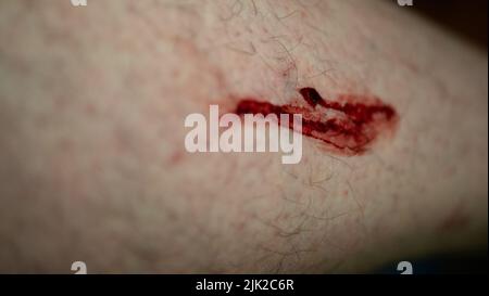 blood flowing from the leg, close up Stock Photo