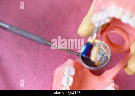 The dentist is holding dentures in his hands. Stock Photo