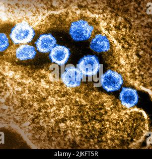 This transmission electron microscope image shows SARS-CoV-2 also known as 2019-nCoV, the virus that causes COVID-19. Virus particles emerge from the surface of a cell cultured in the laboratory. Spikes on the outer edge of virus particles give coronaviruses their name, shaped like a crown. Image captured and colorized at Rocky Mountain Laboratories in Hamilton, Montana. Credit: NIAID Stock Photo