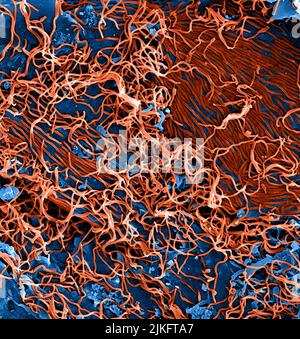 Colorized scanning electron micrograph of filamentous Stock Photo