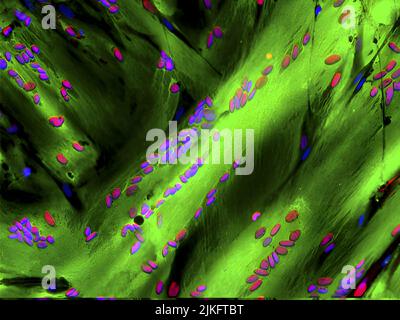 Researchers have determined that the TFIID protein complex controls the stem cell genes that repair skeletal muscle. This image shows differentiated human skeletal muscle fibers (myotubes, in green) protecting the MyoD protein (colored in red), which cooperates with TFIID to transform muscle stem cells into muscle tissue. Cell nuclei are stained blue. This discovery could help develop strategies that activate stem cells to repair muscles degenerated by aging or diseases like muscular dystrophy and cancer. Stock Photo