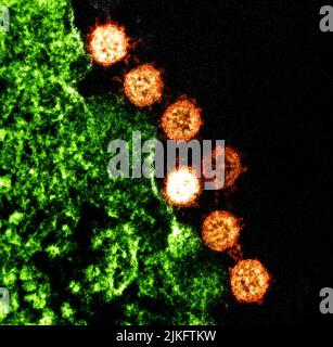 Colorized transmission electron micrograph of Severe Acute Respiratory Syndrome (SARS) virus particles (orange) found near the periphery of an infected cell (green). Stock Photo