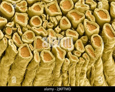 Myelinated axons in a rat vertebral root. Myelin is a type of fat that forms a sheath around and thus insulates the axon to protect it from the loss of the electrical current needed to transmit signals along the axon. The axoplasm inside the axon is shown in pink. Stock Photo