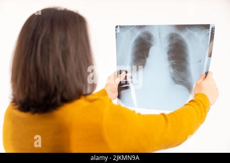 Long haired turned his back man in his 30s looking onto and reading an x-ray of the chest analysis. High quality photo Stock Photo