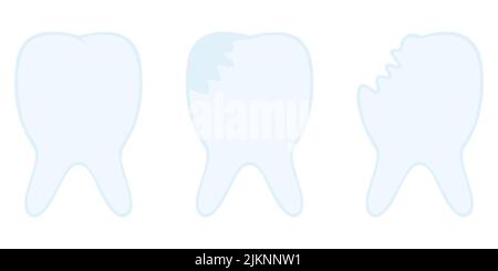 Healthy molar, sick tooth with caries and broken. Set of vector illustrations. Isolated background. Dental care. Cartoon style. Medical theme. Stock Vector