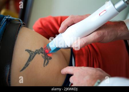 Fractional CO2 laser tattoo removal session in a beauty salon. Stock Photo