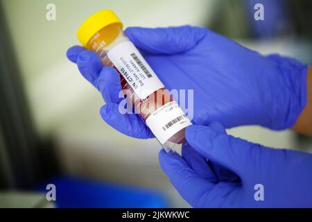 Biobank storing stem cells from blood and cord tissue. Stock Photo