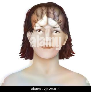 Brain: cerebral hemispheres with longitudinal fissure, cerebellum and brainstem). Stock Photo