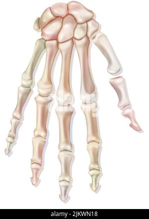 Bones of the Hand, Dorsal View Stock Photo - Alamy