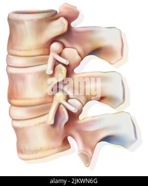 Lumbar nerve roots of the spinal nerves coming out of the lumbar vertebrae. Stock Photo