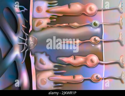 Zoom in on age-related macular degeneration affecting the macula, the central area of the retina. Stock Photo