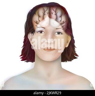 Brain (right and left cerebral hemispheres) in a woman's face. Stock Photo