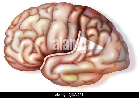 Particularity of the brain of Einstein which presents a fissure of ...