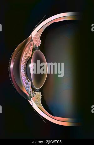 Astigmatic eye (ovoid and non-spherical cornea) with the formation of ...