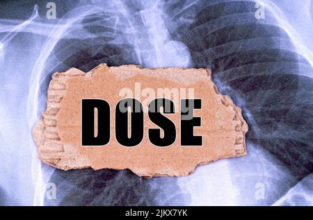 Medicine concept. On the X-ray there is a piece of cardboard with the inscription - DOSE Stock Photo