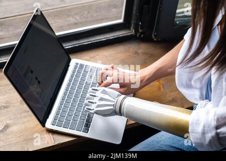 Motivated woman using prosthetic arm working notebook computer, typing text, girl with disability normal life artificial prosthetic limb, people with Stock Photo