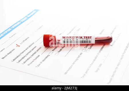 monkeypox virus Positive blood test tube Stock Photo - Alamy