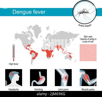 Dengue fever symptoms. infographics and awareness poster. Maps of epidemic dengue. Close-up of Aedes aegypti - mosquito that spreads disease. vector Stock Vector
