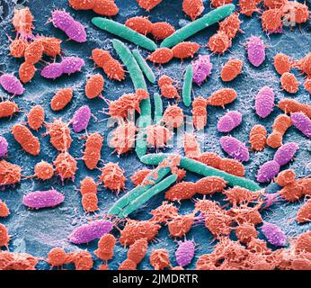 Faecal bacteria. Scanning electron micrograph (SEM) of bacteria found ...