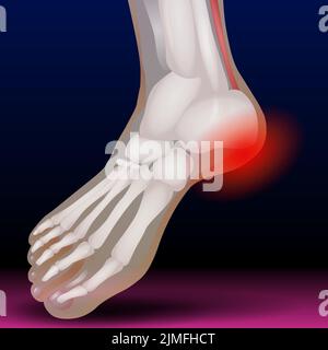 Toe Bone Stock Photo