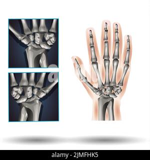 Wrist Anatomy Stock Photo