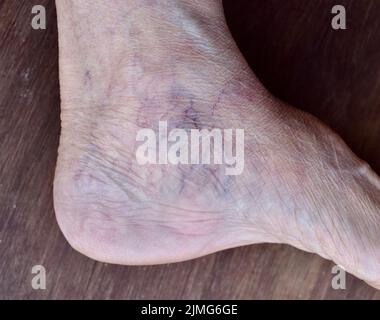 Skin wrinkles and prominent veins visible through the thin foot skin of Asian old woman. Stock Photo