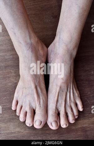 Skin wrinkles and prominent veins visible through the thin foot skin of Asian old woman. Stock Photo