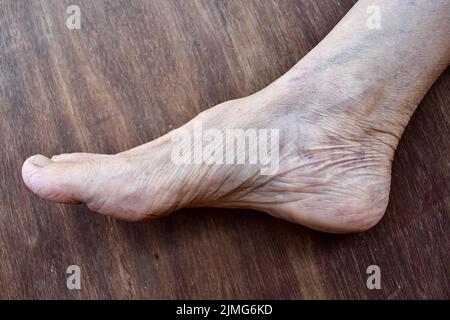 Skin wrinkles and prominent veins visible through the thin foot skin of Asian old woman. Stock Photo