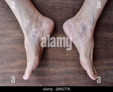 Skin wrinkles and prominent veins visible through the thin foot skin of Asian old woman. Stock Photo