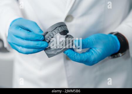Upper and lower jaw of a man printed on a 3d printer of photopolymer Stock Photo