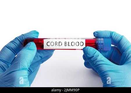 Close up of scientist hand with a cord blood ampoule Stock Photo