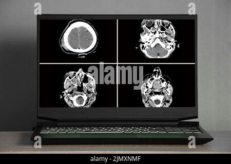 a black laptop with a white screen stands on a table in a room at home, a laptop with a white screen Stock Photo