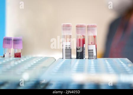 Blood sample in tubes, collected from patients. Close up view. Stock Photo