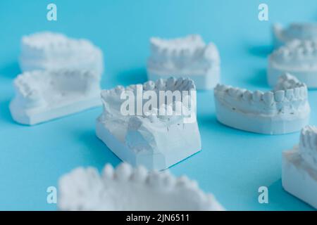 Dental plaster casts of the jaws Stock Photo