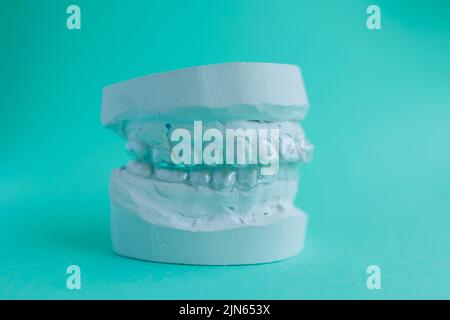 Plaster mould of human jaw with transparent aligner, invisible retainer ...
