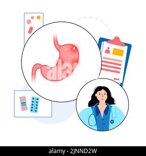 Stomach polyps, illustration Stock Photo