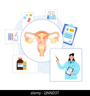 Uterine polyps, illustration Stock Photo