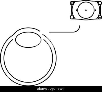 Illustration of ICL (intraocular contact lens) surgery and ICL insertion Stock Vector