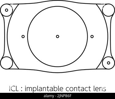 ICL, intraocular contact lens illustration Stock Vector