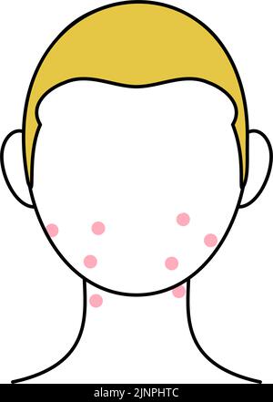 Image of skin problems, men with acne due to skin irritation Stock Vector