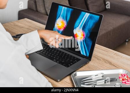 Close up of doctor showing a x-ray of pain in the knee Stock Photo