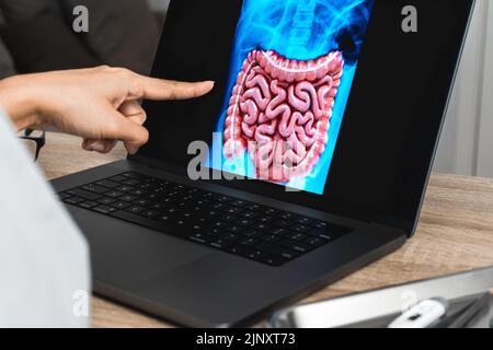 Doctor showing a x-ray of stomach and intestine Stock Photo