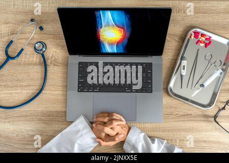 Top view of doctor looking a x-ray of pain in the knee Stock Photo